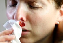 Что нужно знать про носовое кровотечение 10ae7d91-8ece-45ed-bfc8-7c9d3a57b45b-67fc46c9