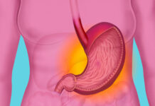 Онколог Макаров объяснил связь язвы желудка с онкологией 142ab9c8-c830-4cec-a076-1b7c7bc2053c-68065dfe