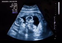 Особенности наблюдения за здоровьем матерей близнецов 53168075-0aba-4eb5-b70d-5f5b88278272-67f3e88b