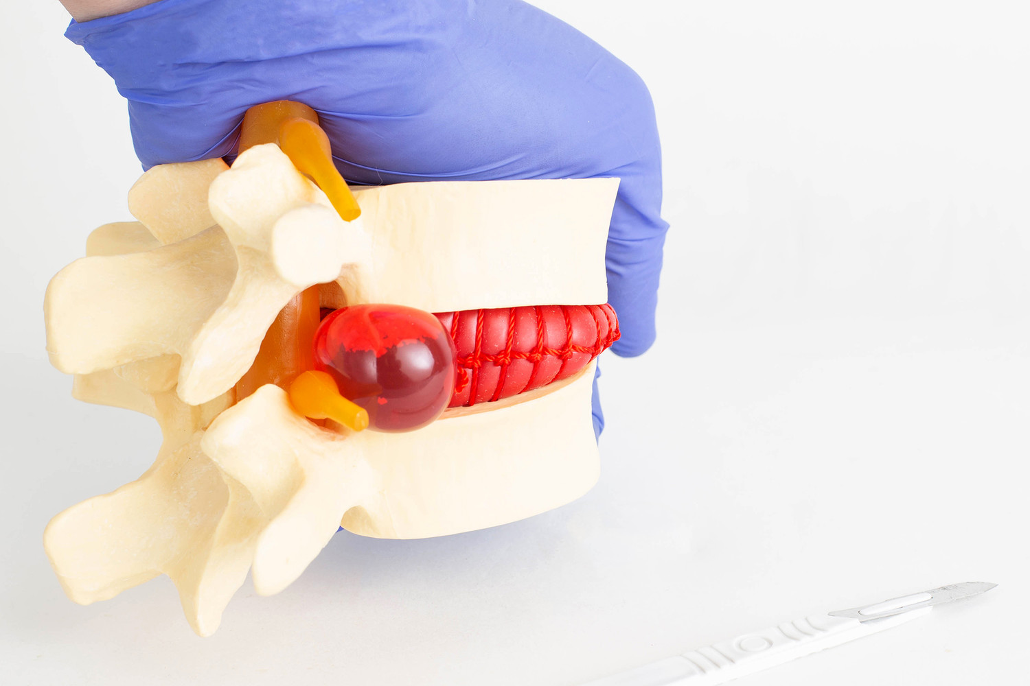 Прорыв Шаньдунского университета: FSP1 как ключ к лечению дегенерации позвоночника-0