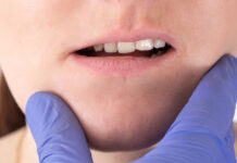 rannee starenie licza mozhno predotvratit s pomoshhyu svoevremennoj korrekczii prikusa-politgolos-ru-174135009000-0