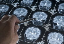 Екатерина Демьяновская о главных вызовах и надеждах в неврологии ekaterina demyanovskaya o glavnyh vyzovah i nadezhdah v nevrologii-politgolos-ru-174349894800-0