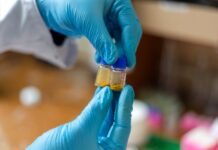 urfu sozdal protivoopuholevyj kompleks v 10 raz effektivnee czisplatina-politgolos-ru-174591811300-0