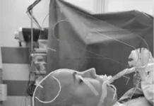 Центр им. Н.Н. Бурденко внедряет нейрохирургический визир для точной диагностики czentr im nn burdenko vnedryaet nejrohirurgicheskij vizir dlya tochnoj diagnostiki-politgolos-ru-174695778500-0