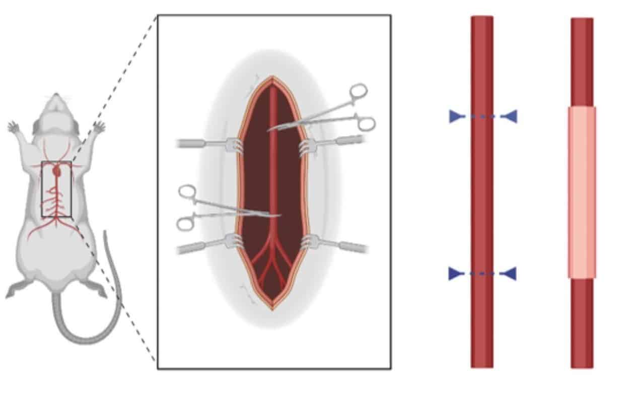 Создана аорта на основе гидрогеля с помощью 3D-принтера в биопечати-0