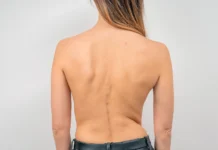 Иван Шитоев и ScolView из Пермского Политеха открывают новые возможности диагностики сколиоза ivan shitoev i iz permskogo politeha otkryvayut novye vozmozhnosti diagnostiki skolioza-politgolos-ru-0