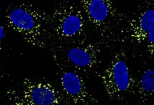 Ученые из Дьюкского и Национального университета Сингапура изучают иммунитет к лихорадке денге с помощью TAK-003 и CYD-TDV uchenye iz dyukskogo i naczionalnogo universiteta singapura izuchayut immunitet k lihoradke denge s pomoshhyu 003 i -politgolos-ru-0