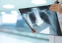 Екатерина Демьяновская подчеркнула важность флюорографии и Манту для здоровья ekaterina demyanovskaya podcherknula vazhnost flyuorografii i mantu dlya zdorovya-politgolos-ru-0