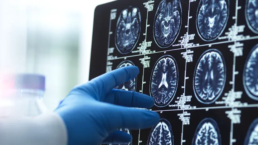 Рентгенолог Азарян рассказал, как перестать бояться МРТ