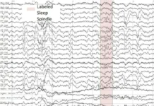Разработка ННГУ использует ИИ для анализа ЭЭГ при эпилепсии и сне razrabotka nngu ispolzuet ii dlya analiza eeg pri epilepsii i sne-politgolos-ru-0