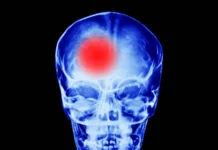 Эксперт Дмитрий Рещиков даёт советы по предотвращению зимних травм головы ekspert dmitrij reshhikov dayot sovety po predotvrashheniyu zimnih travm golovy-politgolos-ru-0