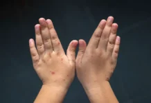 Кхао-Лак вирус Коксаки: Роспотребнадзор, Robinzon дают рекомендации khaolak virus koksaki rospotrebnadzor dayut rekomendaczii-politgolos-ru-0