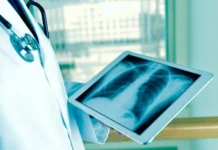 МГУ: нейросети и FABEMD улучшают диагностику туберкулеза mgu nejroseti i uluchshayut diagnostiku tuberkuleza-politgolos-ru-0