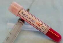 ВОЗ и Роспотребнадзор: вирус Нипах не угрожает россиянам voz i rospotrebnadzor virus nipah ne ugrozhaet rossiyanam-politgolos-ru-0