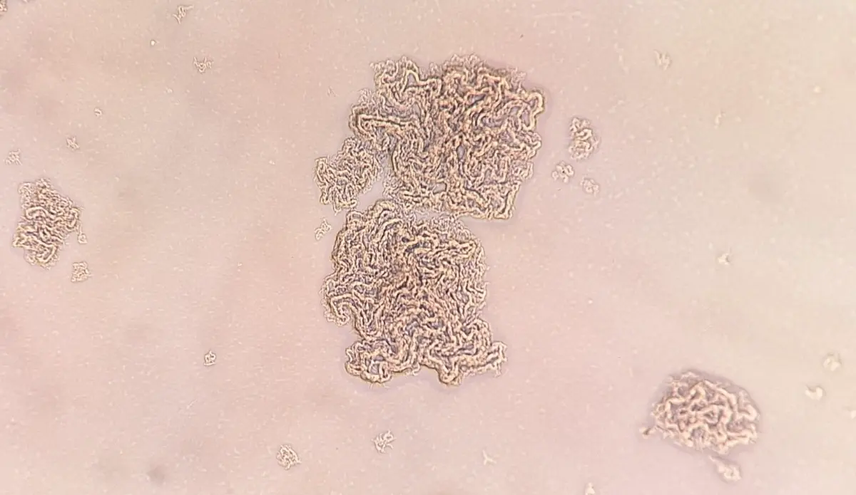 Макрофаги против туберкулеза – новый взгляд на борьбу с инфекцией-0