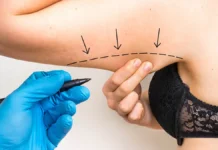 РЕН ТВ о том, как Лидокаин изменил процедуру в Лайкми ren tv o tom kak lidokain izmenil proczeduru v lajkmi-politgolos-ru-0