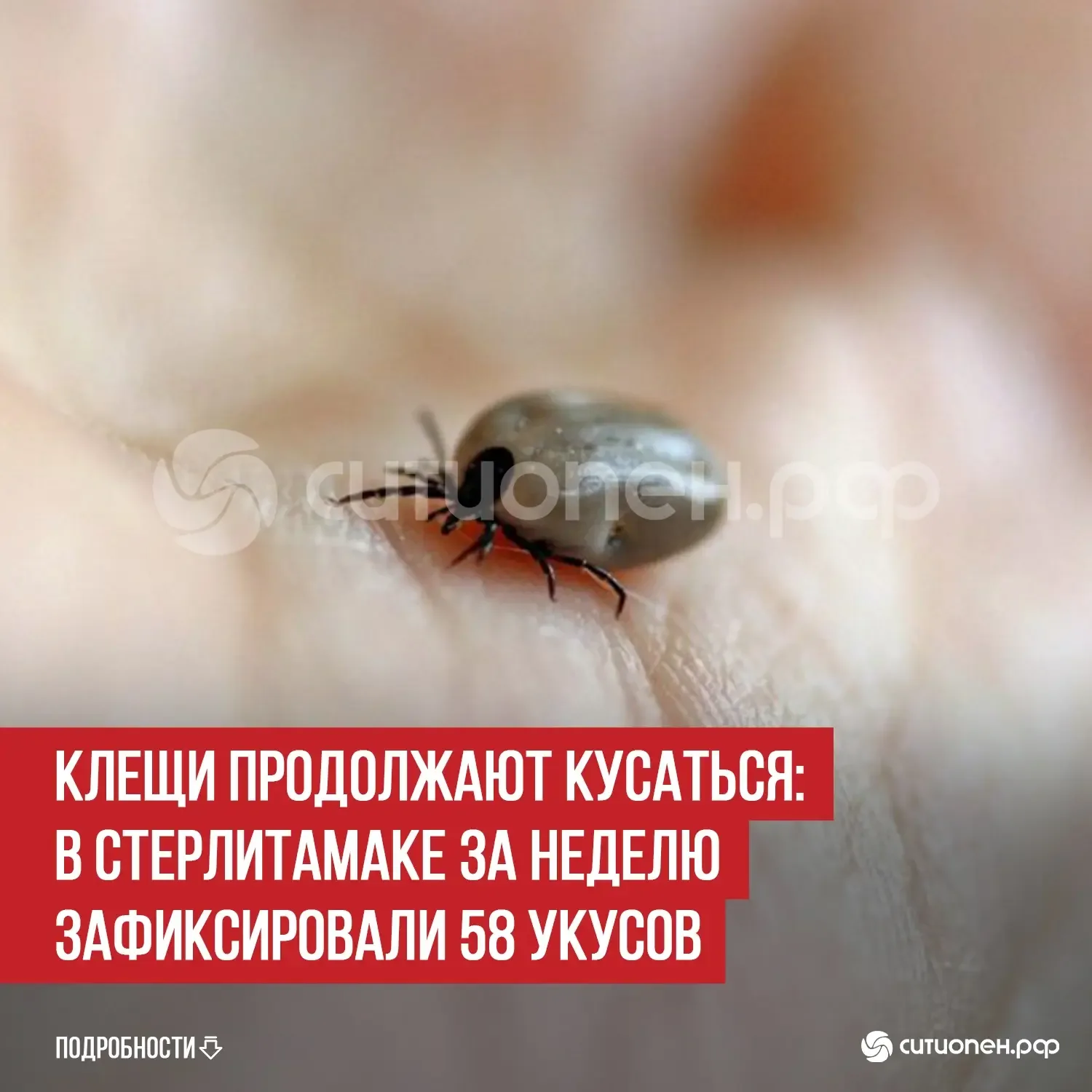 Клещи продолжают кусаться: в Стерлитамаке за неделю зафиксировали 58 укусов   В Стерлитамаке снова в