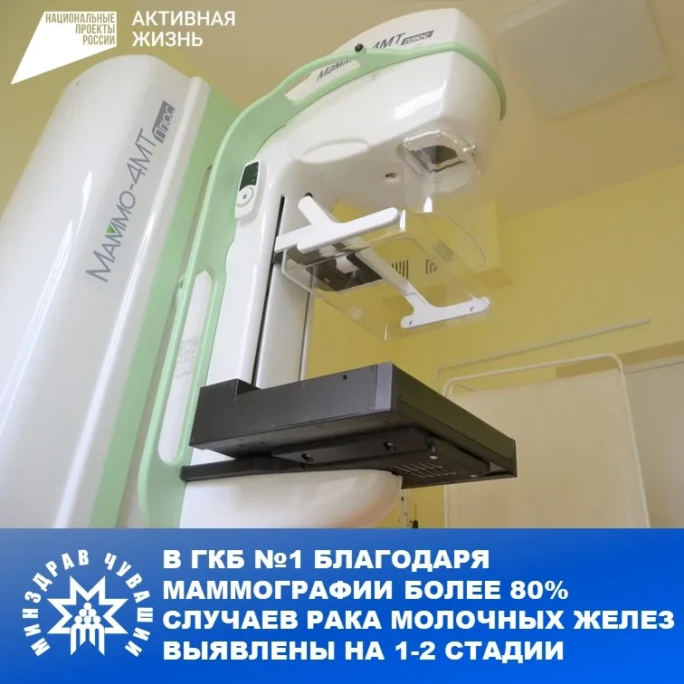 В 2025 году маммографическое обследование в Городской клинической больнице №1 прошли более 26 тысяч 