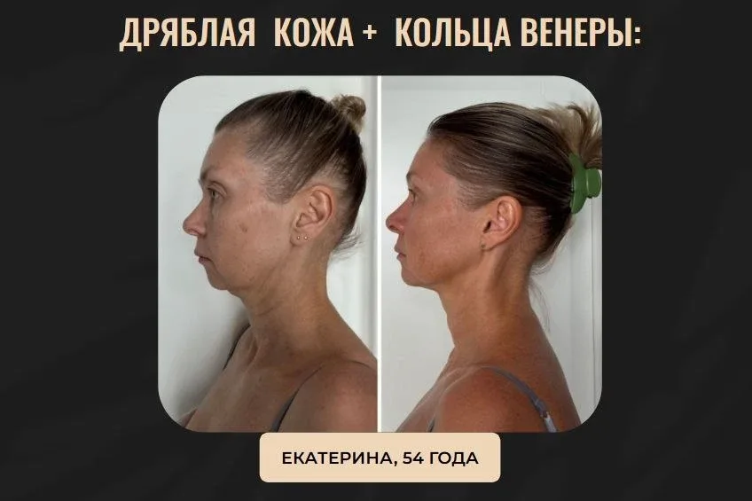 ❔ Как вернуть шею, если она «спряталась» в плечах  Если шея «потерялась» между плечами — это не пово