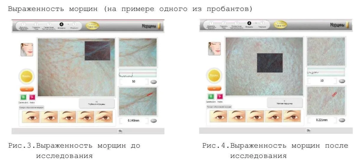 По сыворотке с HPR и ретиналем (которая стоит как половина бокса Лаки) есть результаты клинических и
