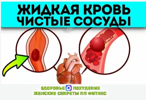 💧 Разжижаем кровь и избавляемся от тромбозов без таблеток  🍽 Морская капуста — помогает поддерживать
