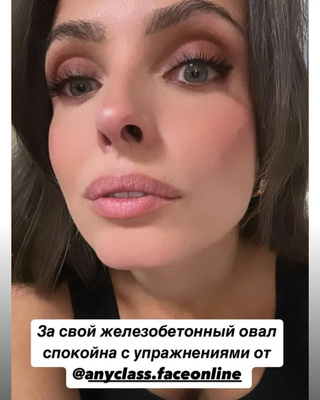 🧨 Почему филлеры не вернут вам молодость лица  Когда слышу что овал лица можно вернуть только «тяжёл