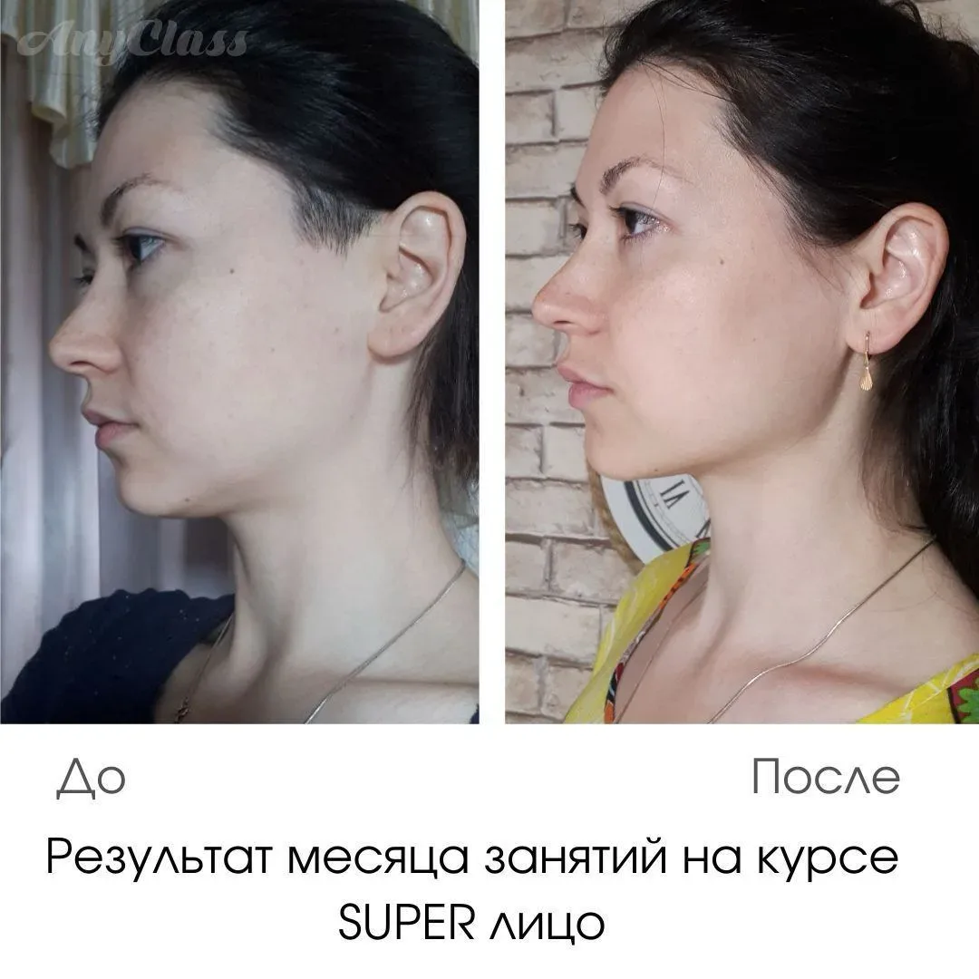 Друзья, второй подбородок появляется не от переедания… Облом, правда? Даже имея лишний вес можно име