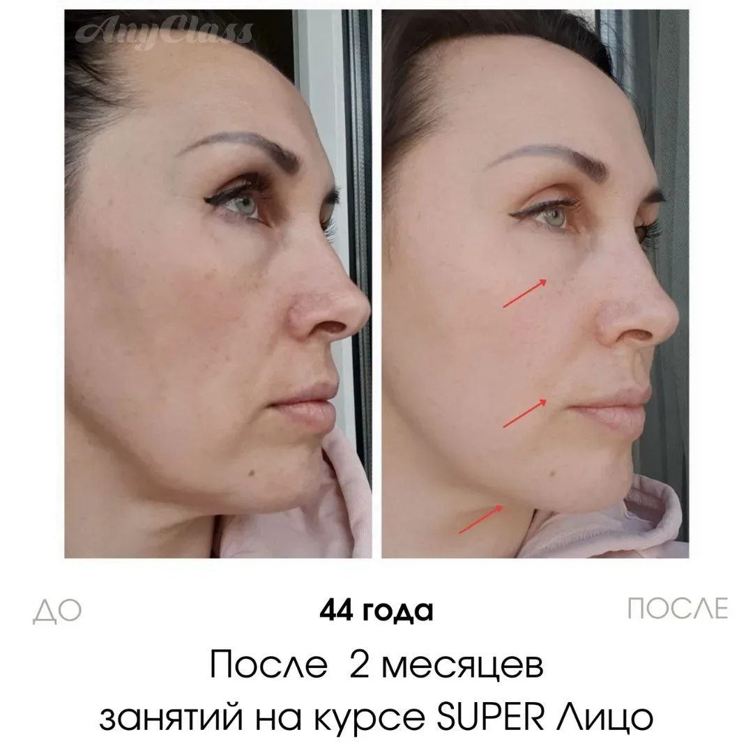 Друзья, второй подбородок появляется не от переедания… Облом, правда? Даже имея лишний вес можно име