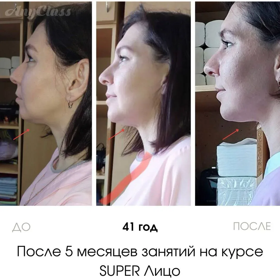 Друзья, второй подбородок появляется не от переедания… Облом, правда? Даже имея лишний вес можно име