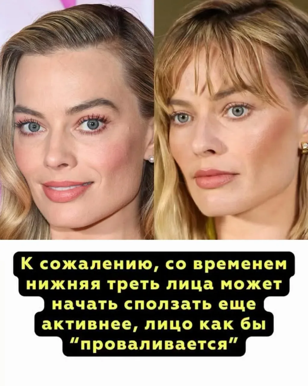 🧨 Удаление комков Биша: как вы РАЗРУШАЕТЕ свое лицо  Комки Биша - это не просто «лишний жир», которы
