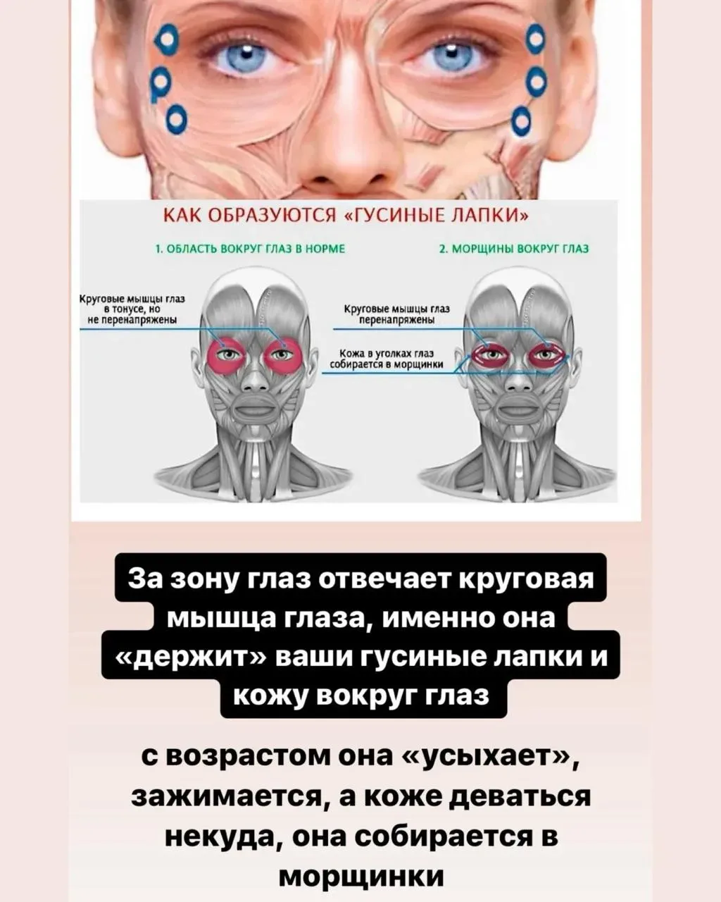 👁️ Когда гусиные лапки - это не конфетки из детства   Прищуриваешься перед экраном? Смеёшься от души