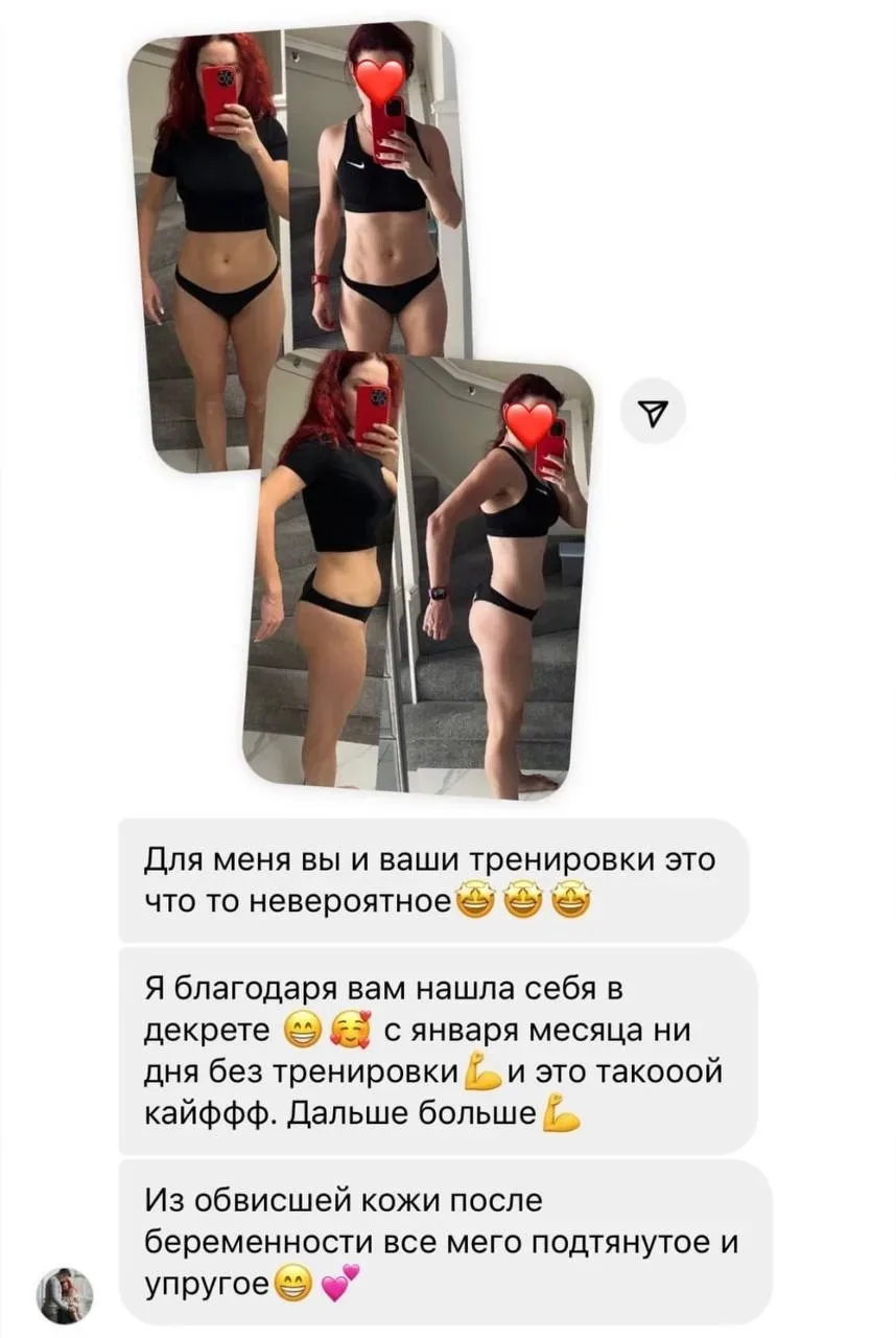 Из обвисшей кожи после беременности все тело подтянутое и упругое  #отзыв  Шикарный свежий кейс 😍 Бе