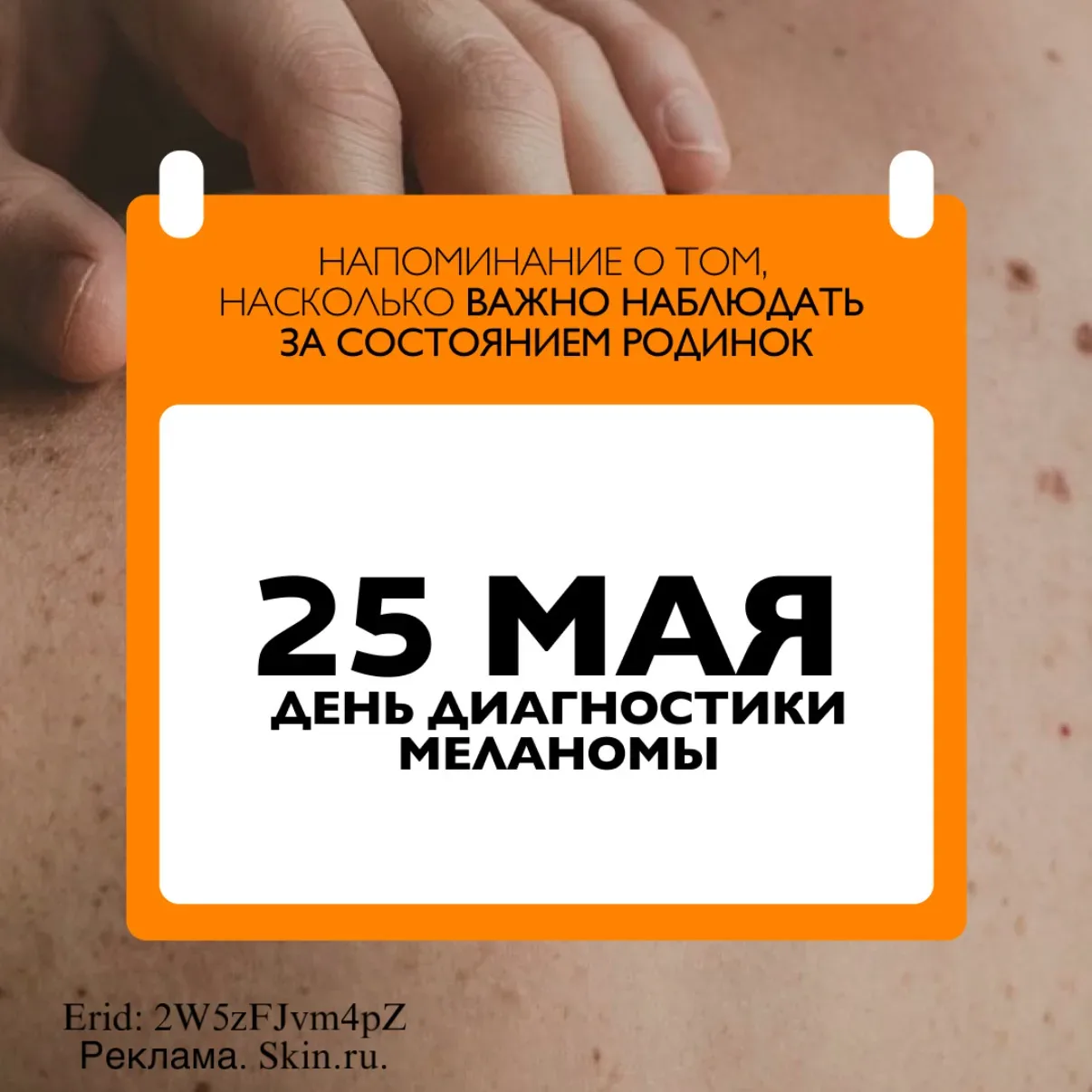 Спокойствие начинается с заботы о себе. Проверьте родинки бесплатно!  Меланома - одна из самых агрес
