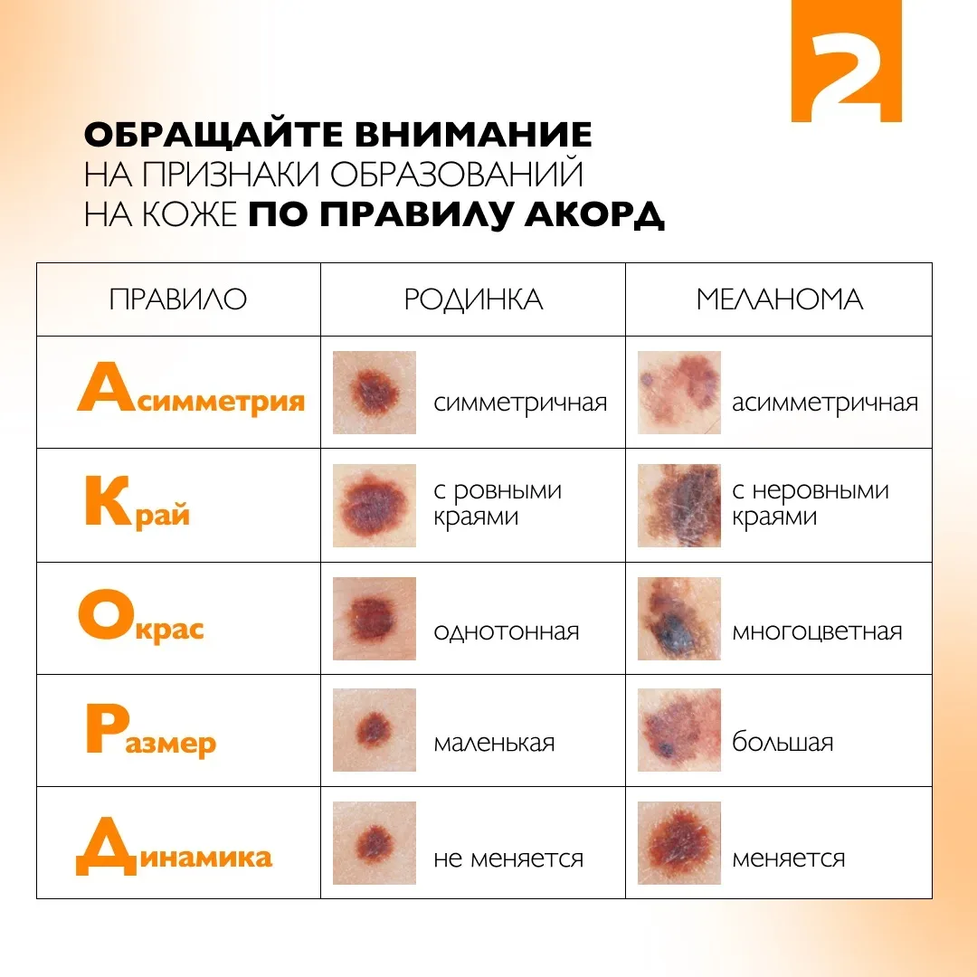 Спокойствие начинается с заботы о себе. Проверьте родинки бесплатно!  Меланома - одна из самых агрес