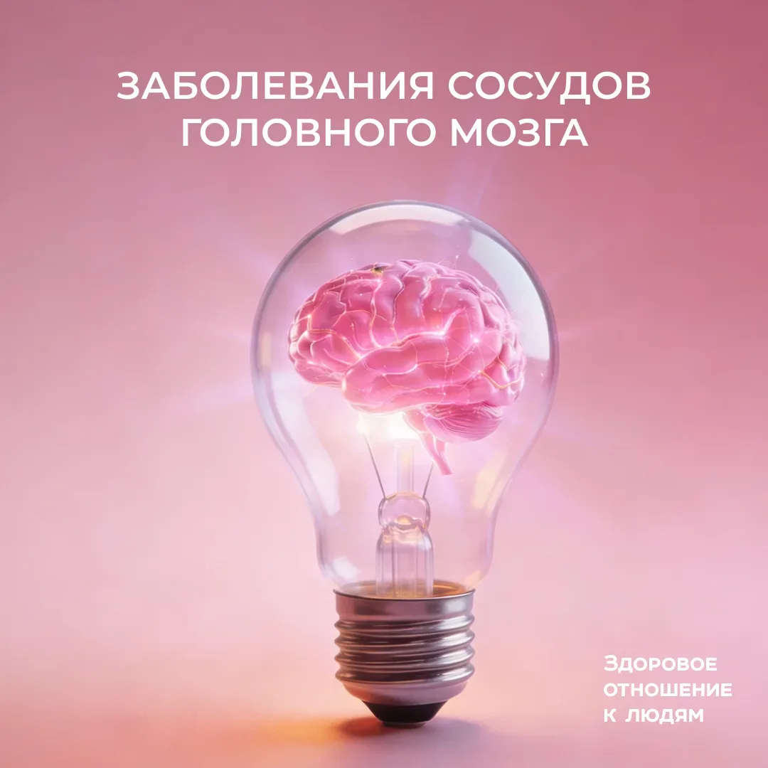 🧠 Заболевания сосудов головного мозга  Как проявляются? И как избежать?  В современной жизни головна