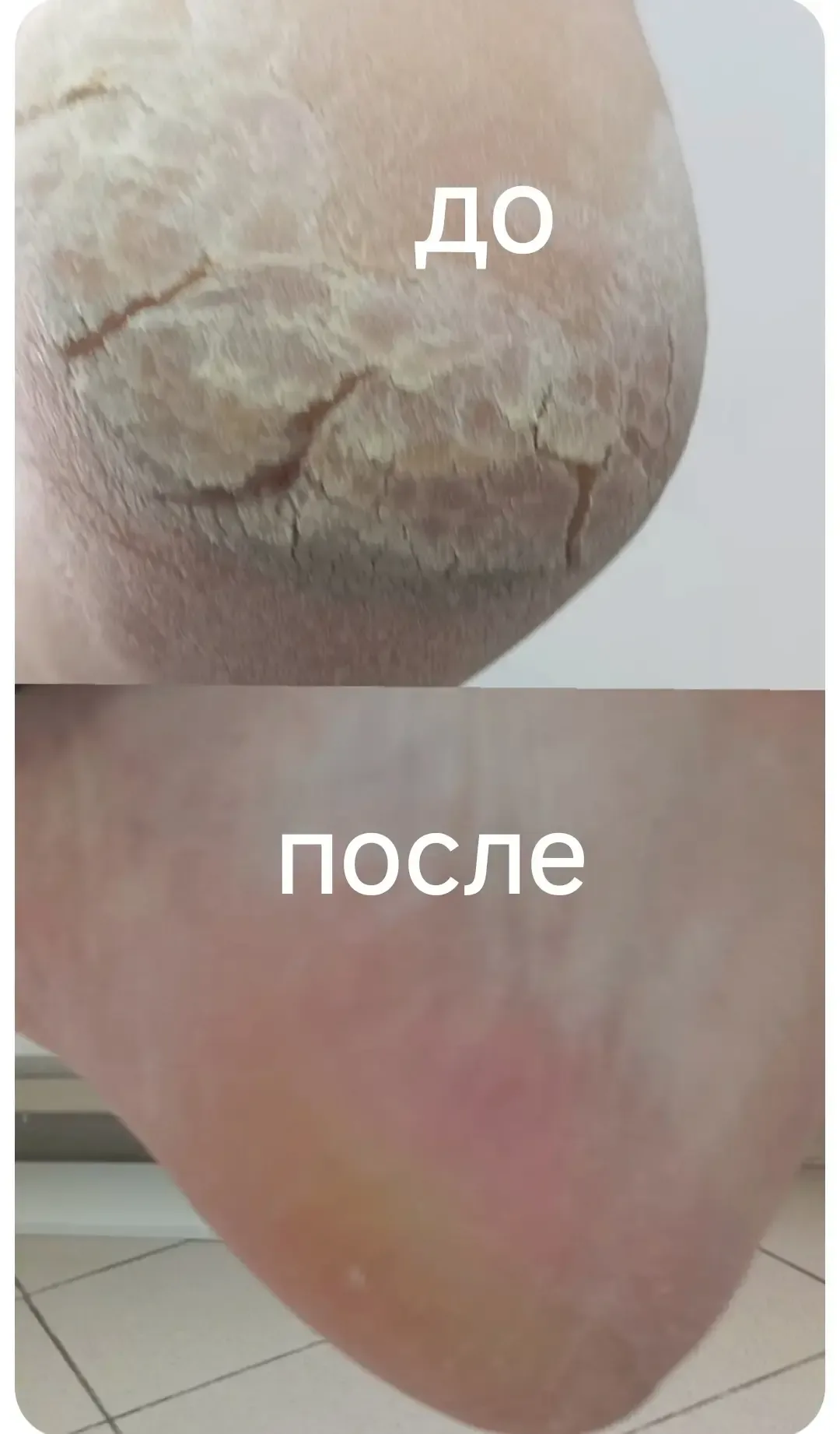 #соцконтракт_в_действии   Благодаря соцконтракту усольчанка Татьяна Пихур смогла заняться любимым де