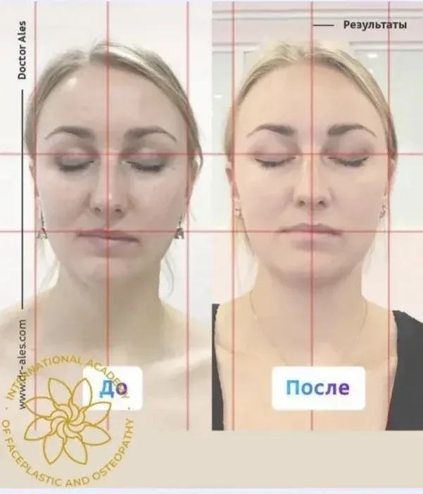 📐 Большинство людей даже не догадывается, что асимметрия лица — это не просто «особенность внешности