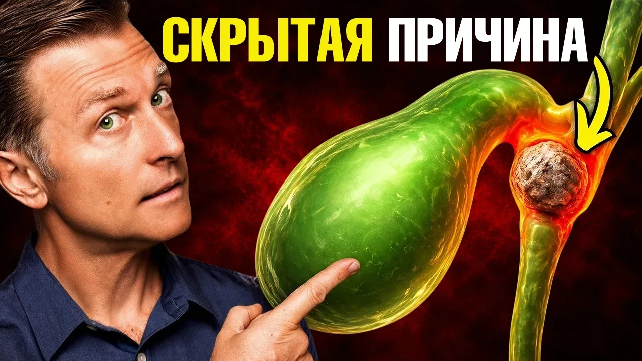 🔔  НОВОЕ ВИДЕО 🔔 КАМНИ В ЖЕЛЧНОМ: МИФЫ И ПРАВДА   Большинство людей думают, что желчные камни образу