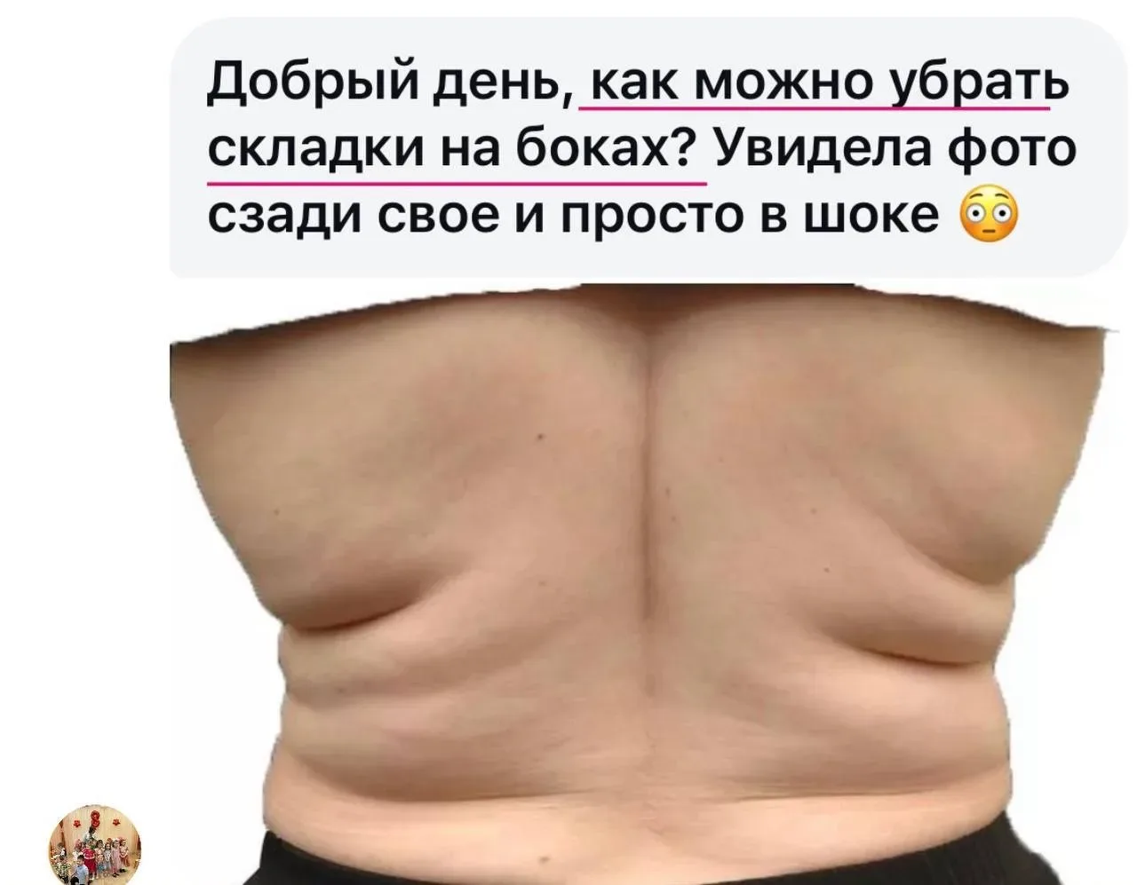 Одна из самых проблемных зон даже у стройных девушек - складки и валики на боках.   Ставьте реакции,