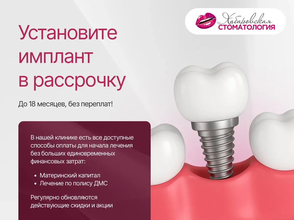 Имплантация зубов всего от 2.000 ₽ / мес  Вернём зубы и красивую улыбку с помощью имплантации за 3-9