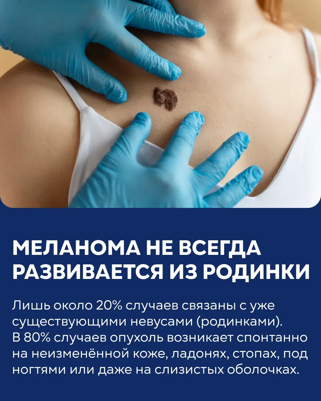 ⚡️11 мая — Всемирный день борьбы с меланомой. Интервью с заместителем главного врача  по онкологии к