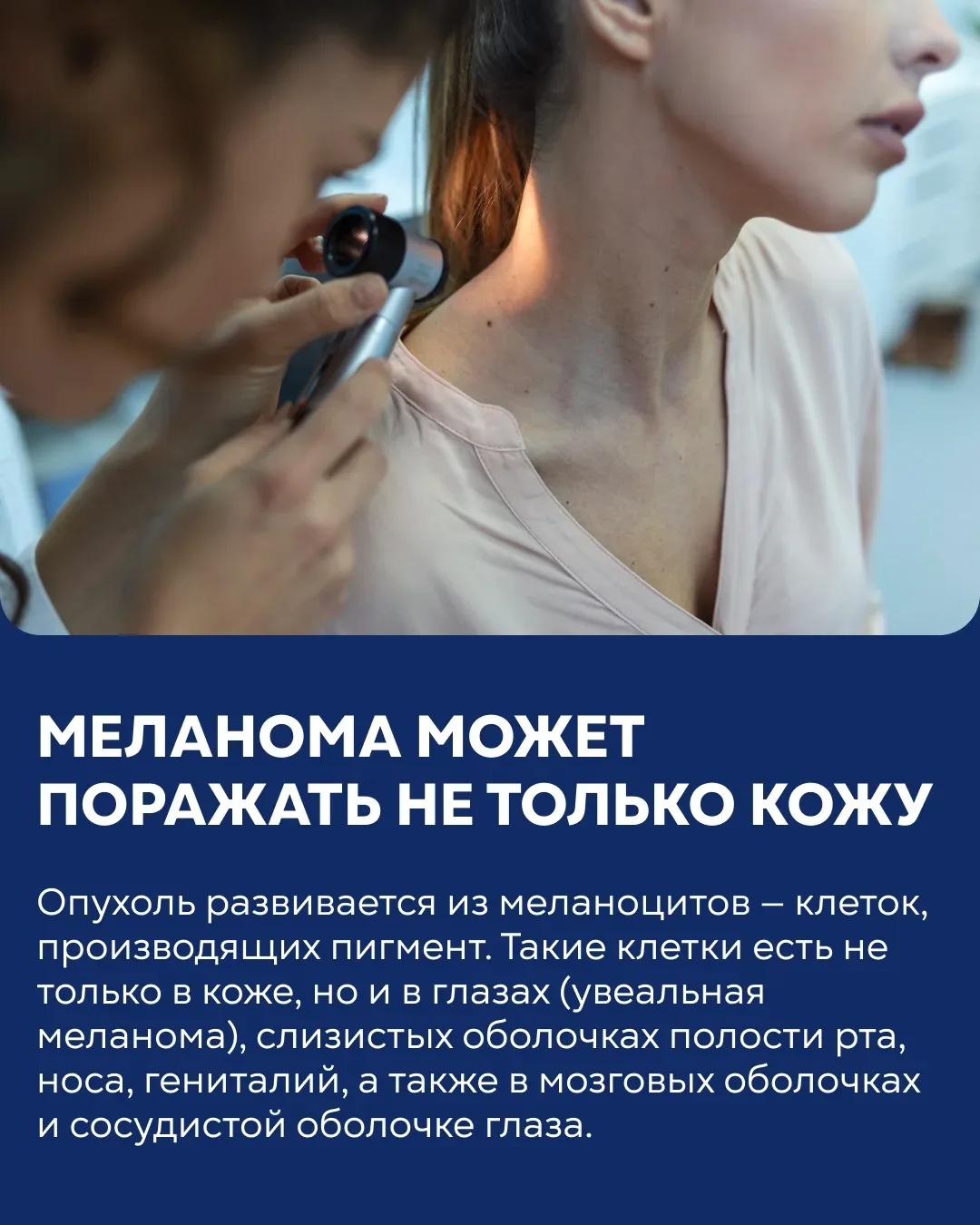 ⚡️11 мая — Всемирный день борьбы с меланомой. Интервью с заместителем главного врача  по онкологии к