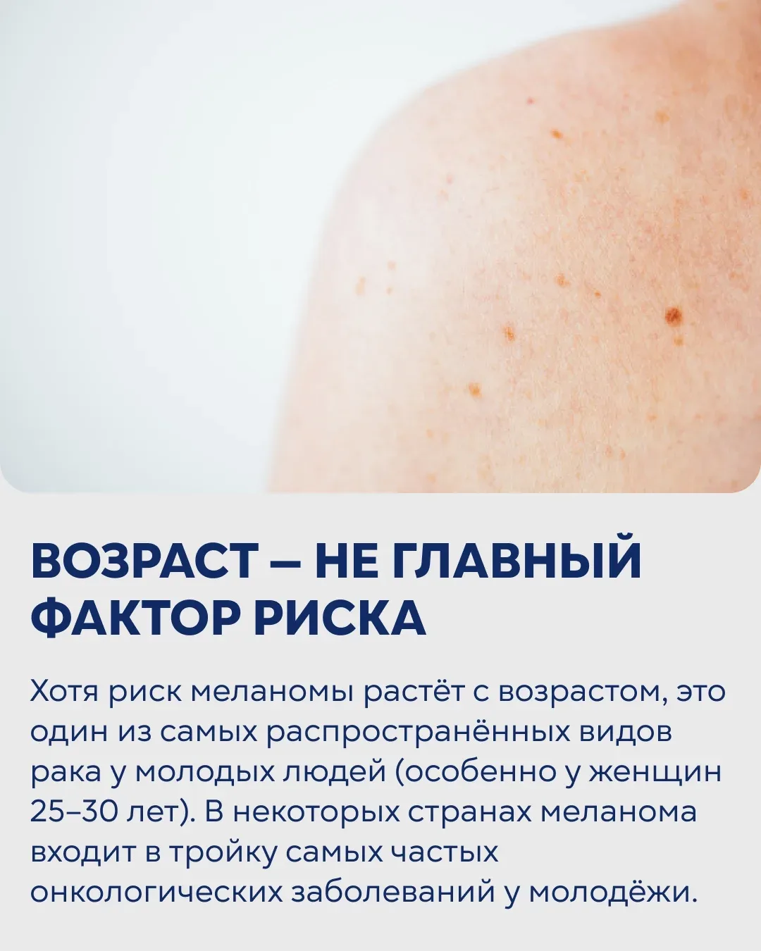 ⚡️11 мая — Всемирный день борьбы с меланомой. Интервью с заместителем главного врача  по онкологии к