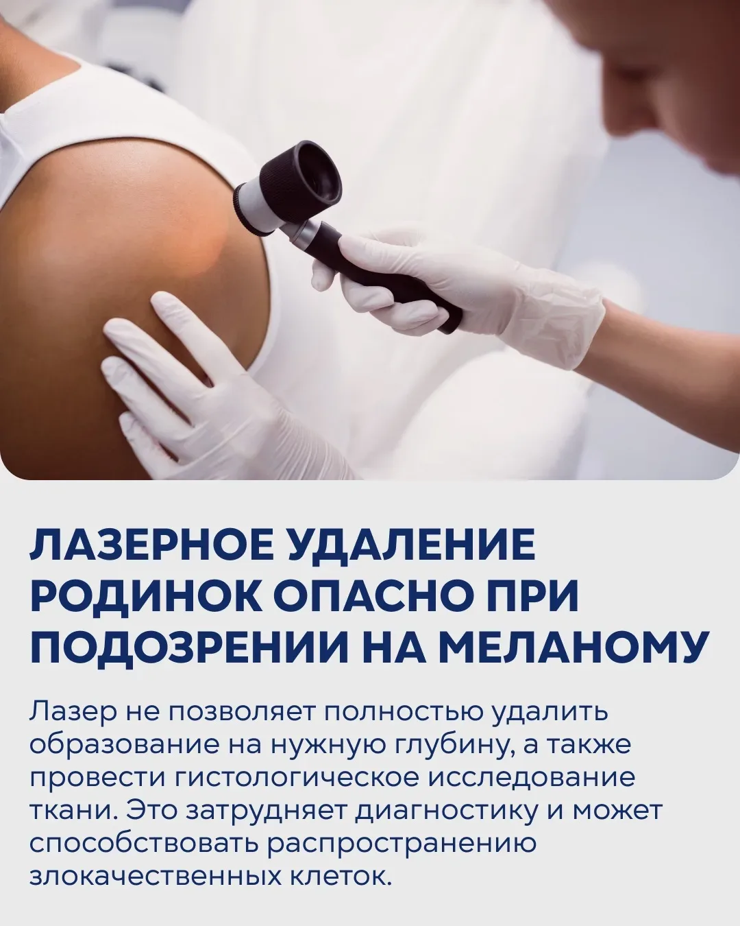 ⚡️11 мая — Всемирный день борьбы с меланомой. Интервью с заместителем главного врача  по онкологии к