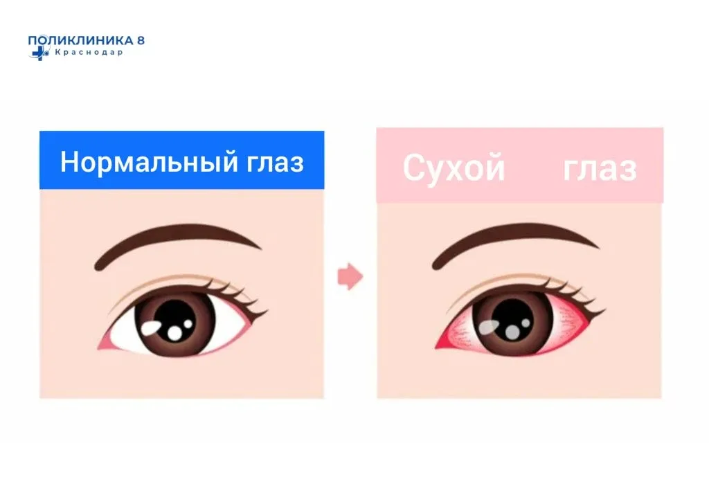 Синдром сухого глаза — уже не про бабушек и дедушек. Теперь это про нас.  Представьте: каждый второй
