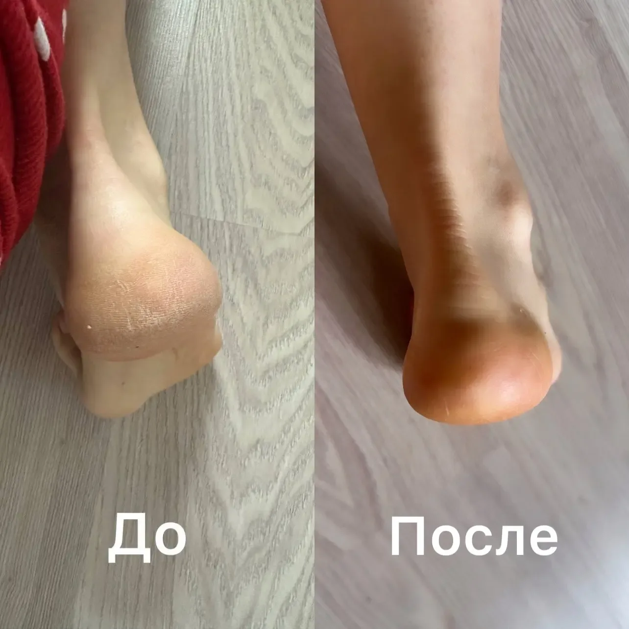 Если вы тоже мучаетесь от сухой кожи, трещинок на пятках. То сегодня моя рекомендация для вас. Мне о