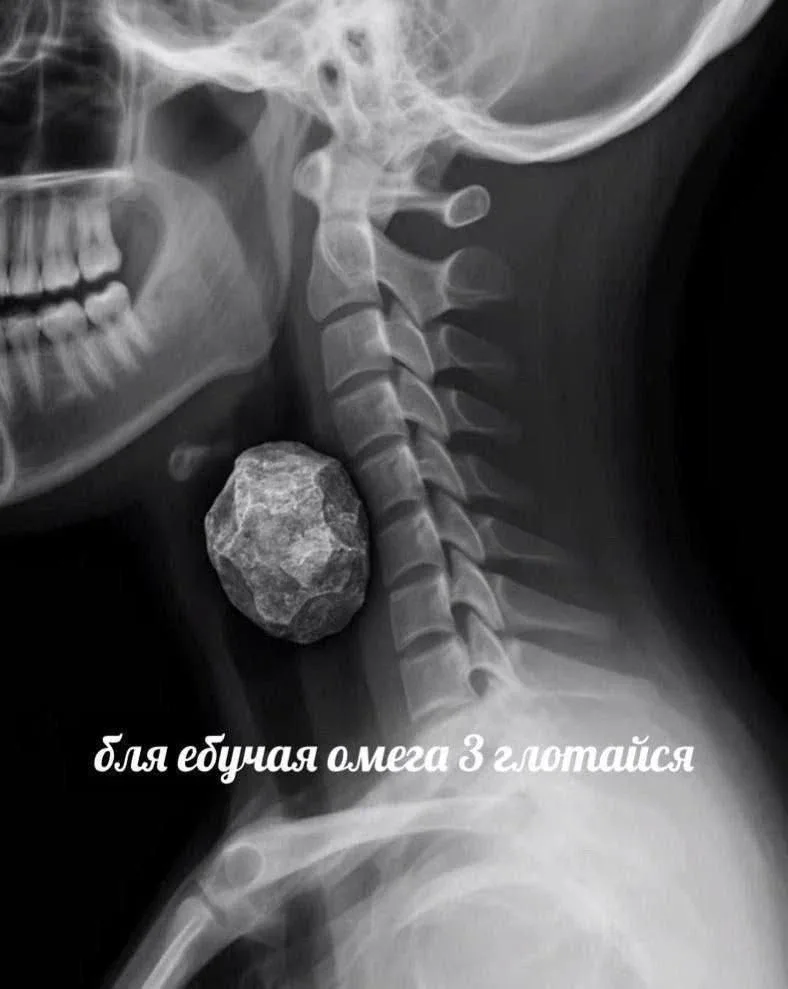 Страх №374 - умереть от зожа   Ладно, шучу, полный зож мне пока не грозит 😁
