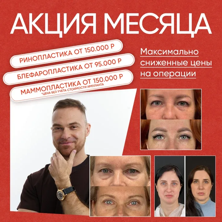 Ребята! Кажется нашли хирурга, которому можно доверить изменения своей внешности. Сейчас открыт набо