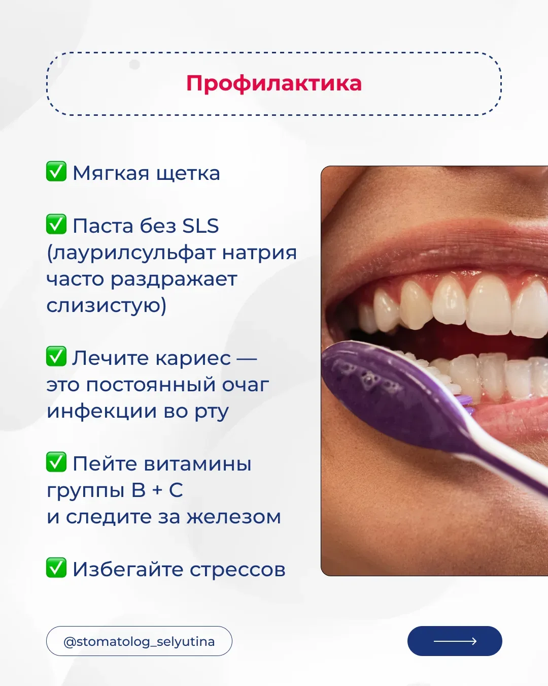 Сталкивались со стоматитом? Как лечили?  Юлия Селютина — ваш проводник в вопросах здоровья зубов 🦷
