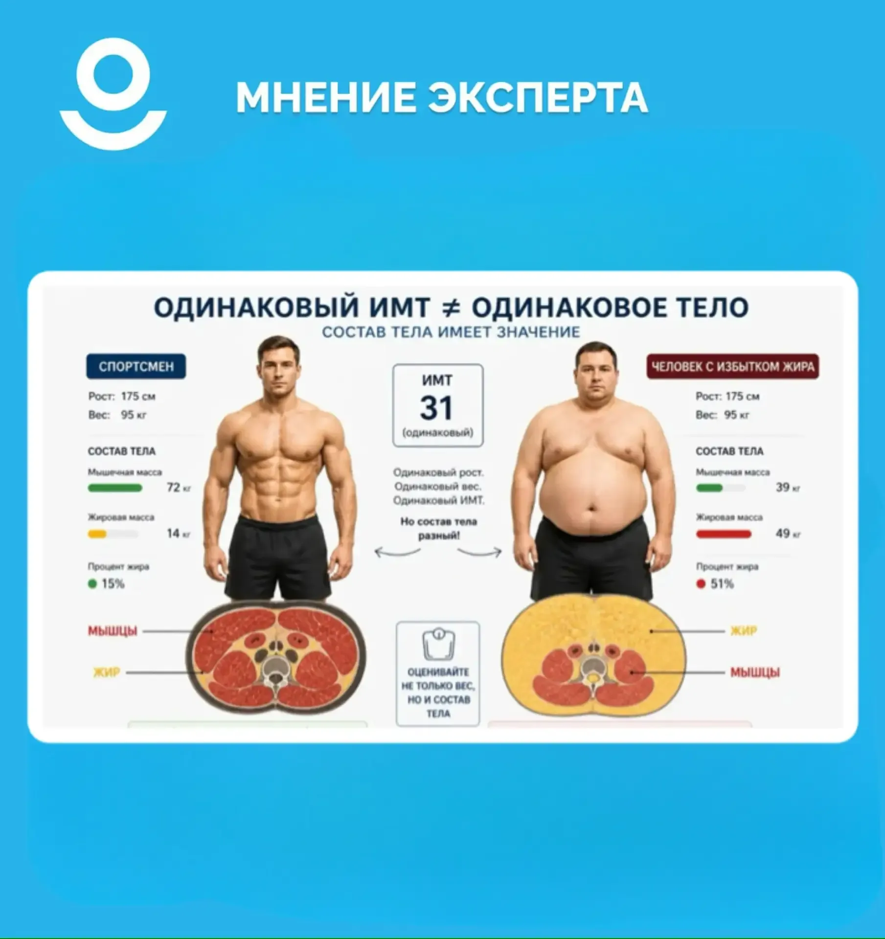 САРКОПЕНИЧЕСКОЕ ОЖИРЕНИЕ ПРИ САХАРНОМ ДИАБЕТЕ 2 ТИПА - СКРЫТАЯ ПРОБЛЕМА, КОТОРУЮ ЧАСТО НЕДООЦЕНИВАЮТ